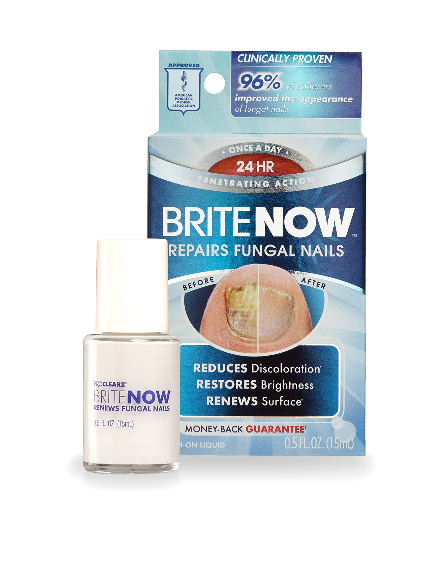 Proclearz Brite Now Nail Treatment, Restores The Appearance Of Damaged & Discolored Nails, Peel-Away Technology, Brightening & S