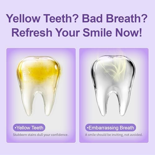 Miss Magic Purple Luxe Whitening Toothpaste – Fluoride Free,Color Correcting,Probiotic Oral Care,Fights Stains,Freshens Breath,Brightens Yellow Teeth,Supports Enamel Health 4.3oz