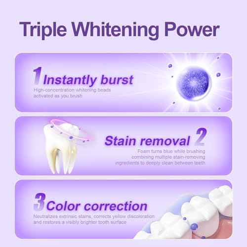 Miss Magic Purple Luxe Whitening Toothpaste – Fluoride Free,Color Correcting,Probiotic Oral Care,Fights Stains,Freshens Breath,Brightens Yellow Teeth,Supports Enamel Health 4.3oz