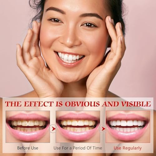 SP-6 Probiotics Whitening Toothpaste, SP6 Probiotic Toothpaste for Teeth Whitening and Gum Health, Enhanced Formula with 6 Probiotics, Fluoride-Free, Minty Fresh Flavor (2)