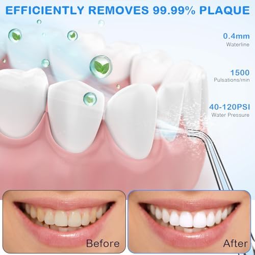 Water Dental Flosser for Teeth Cleaning and Flossing with Travel Size Case – Rechargeable Oral Irrigator, Water Flosser for Adults, IPX7 Waterproof, 5 Jet Tips & 4 Modes