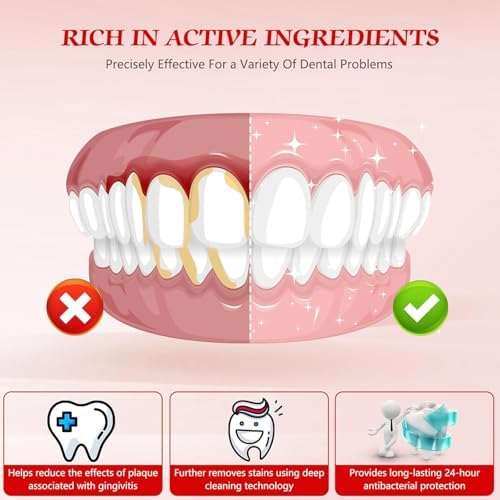 SP-6 Probiotics Whitening Toothpaste, SP6 Probiotic Toothpaste for Teeth Whitening and Gum Health, Enhanced Formula with 6 Probiotics, Fluoride-Free, Minty Fresh Flavor (2)