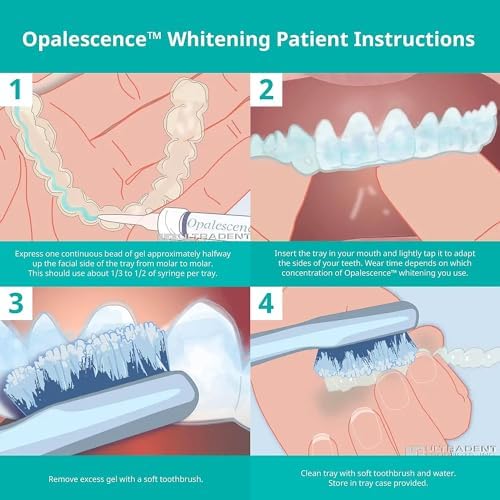 Opalescence 35% Gel Syringes Teeth Whitening - Refill Kit (2 Pack / 4 Syringes Total) Carbamide Peroxide. Made by Ultradent, in Melon Flavor. Tooth Whitening Refill Syringes 5404-1