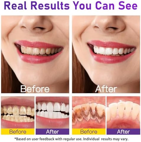 Teeth Whitening Powder - Teeth Whitening - Removes Stains - No Sensitivity - Toothpaste Power - Breath Freshener - for Coffee, Tea and Tobacco Stains 15g