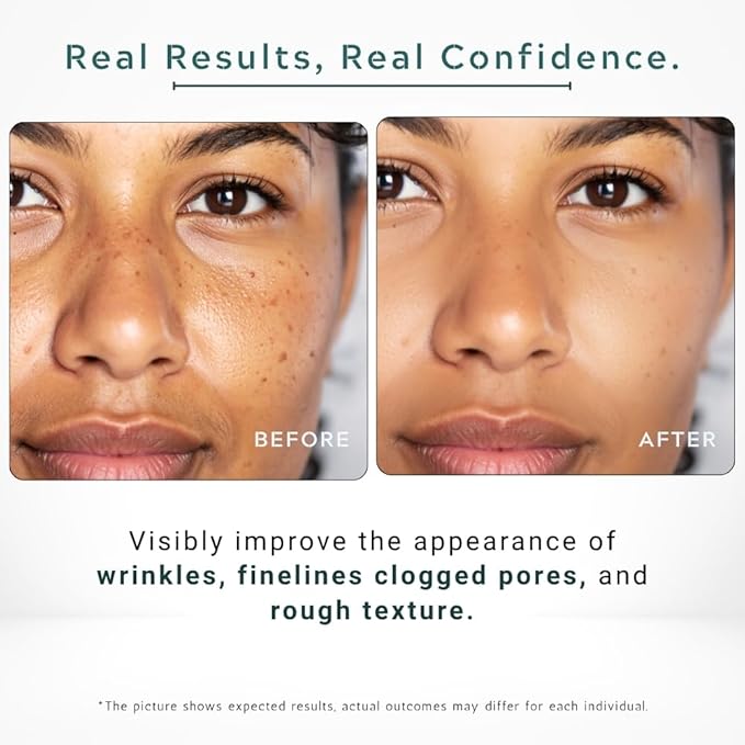 Vitamin C Serum 23% with Retinol and Salicylic Acid – 1 fl.oz