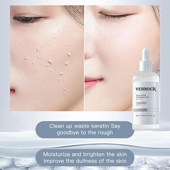 7% Glycolic Acid Exfoliating Toner, Exfoliating Facial Toner, Pore Minimizing Toner, Smooth Skin, Even Tone, Hydrating Formula