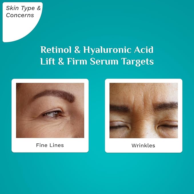 Korean Retinol 0.5% Serum with 1% Hyaluronic Acid by Pilgrim | Anti-Aging Face Serum | Reduces Fine Lines & Wrinkles | Lift & Firm | For Men & Women, All Skin Types | 1.01 Fl Oz (30ml)