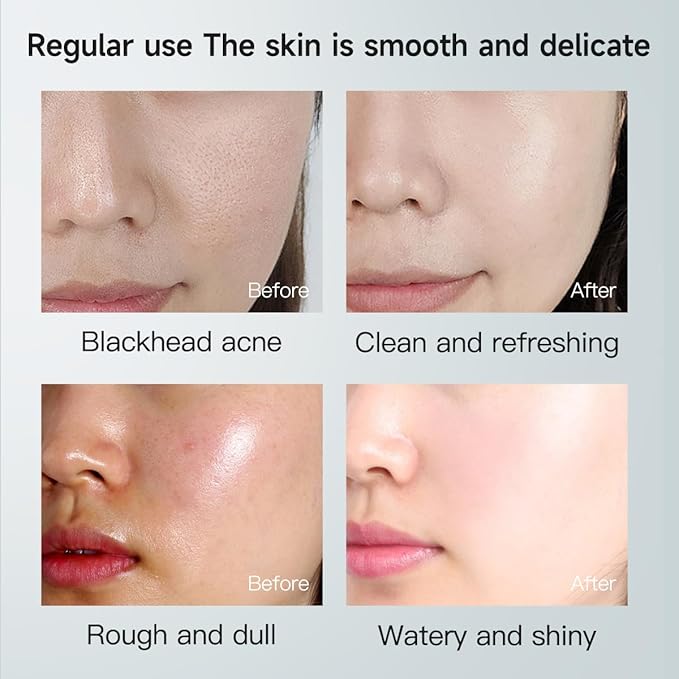 7% Glycolic Acid Exfoliating Toner, Exfoliating Facial Toner, Pore Minimizing Toner, Smooth Skin, Even Tone, Hydrating Formula