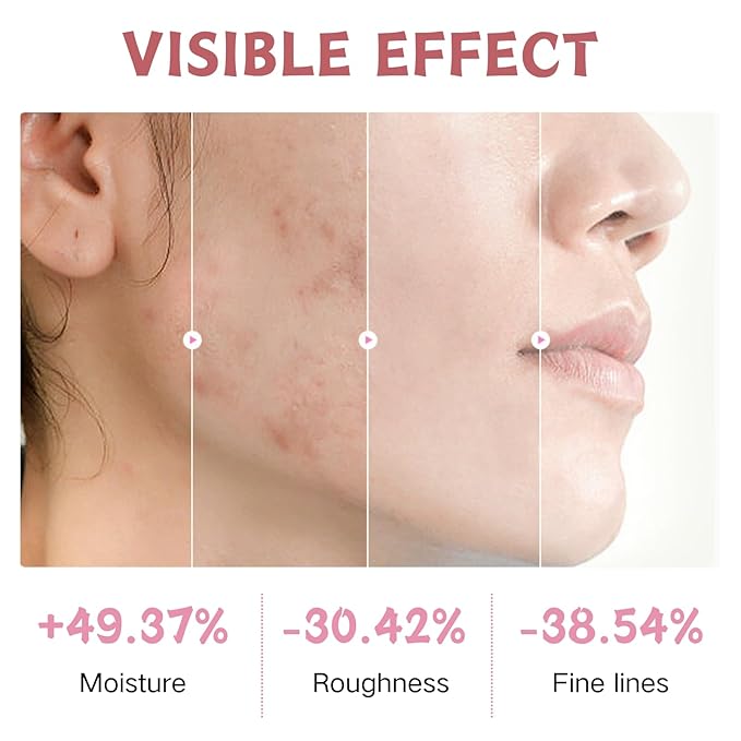 9 Pcs Japan Sakura Skincare Set Teen Girls Gifts - Skin Care for Teens 10-12 - Japanese Skin Care Routine Kit for Women - Travel Size Face Care Set with Cleanser,Sunscreen,Headband,Roller