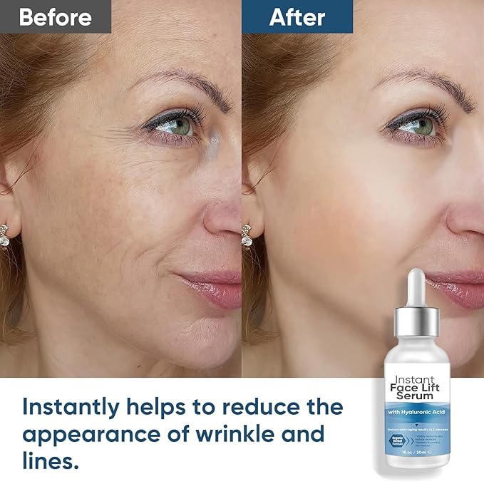 Instant Face Lift Serum, 2 Minute Temporary Skin Tightening Serum with Hyaluronic Acid, Visibly Lift & Firm Sagging Skin for Face & Neck