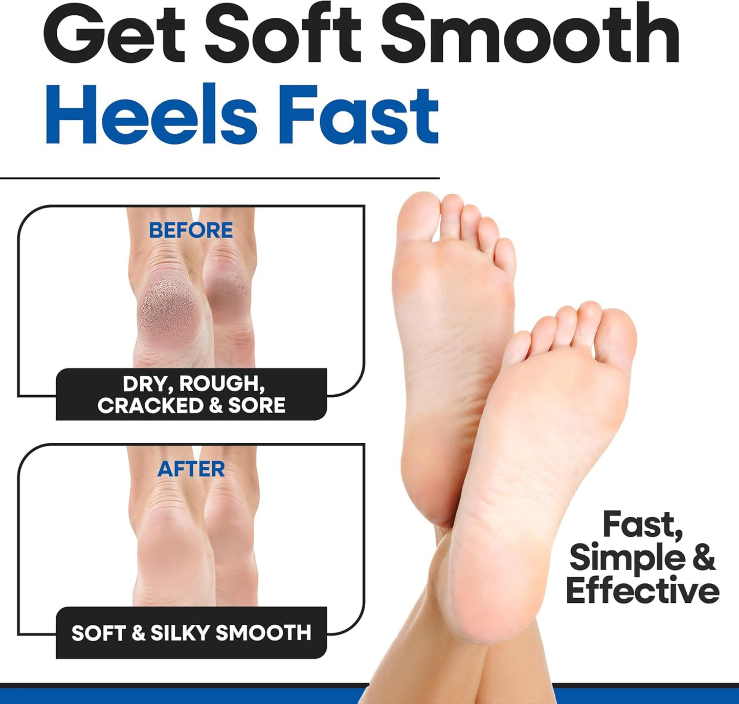 Moisturizing Socks for Women & Men | Aloe Vera Cracked Heel Treatment | Foot Callus Remover | Aloe Socks for Cracked Heels & Dry Cracked Feet | Lotion Infused Gel Heel Socks (Large - 3 Pairs)