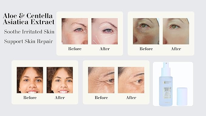 Retinol Night Serum Anti-Aging Facial Serum Firms Face & Neck Hyaluronic Acid, Niacinamide, Collagen, Glycolic Acid, Squalane Vitamin C & E (1.7fl, Hydration Boost)
