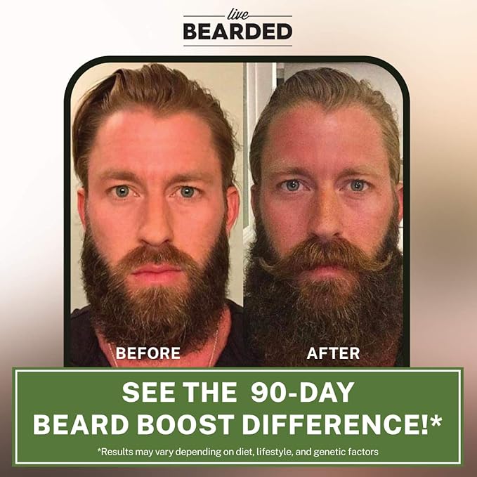 Live Bearded Beard Boost - Hair Growth Multivitamins with Biotin 10,000mcg, Vitamins C, E and Zinc - Thick, Strong, Full Grow Support - Made in The USA | 90-Day Supply