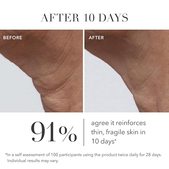 Algenist GENIUS Ultimate Anti-Aging Cream, Travel Size - Vegan Firming & Smoothing Moisturizer with Alguronic Acid & Microalgae Oil - Non-Comedogenic & Hypoallergenic Skincare (0.5 oz)