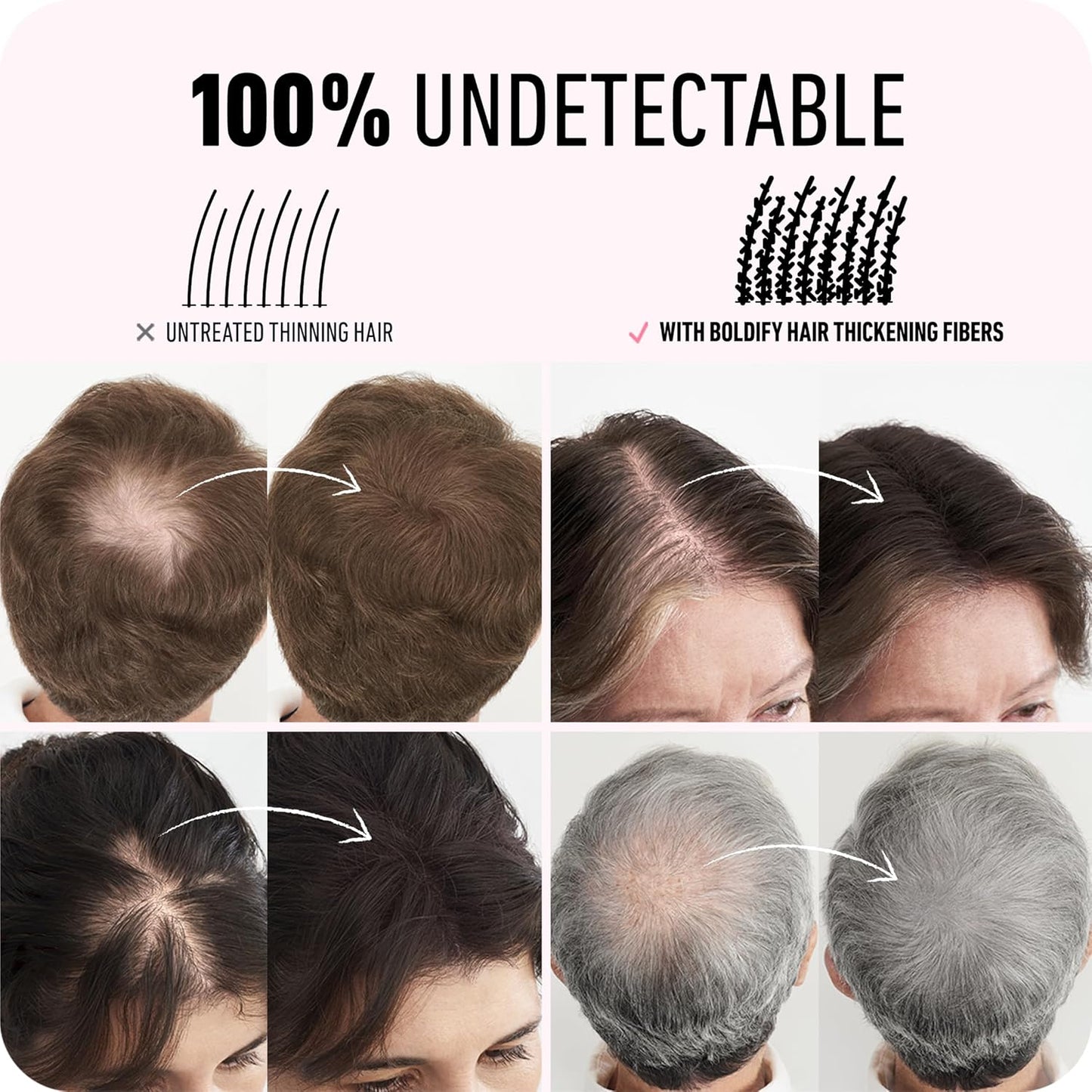 BOLDIFY Hair Fibers 28g | Thinning Hair Solution | Ash Brown for Men & Women
