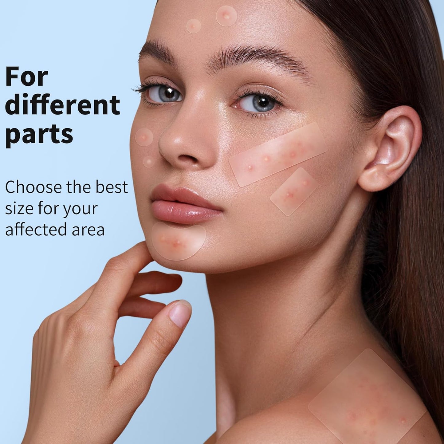 Large Hydrocolloid Acne Patches | 400 Count | Effective Zit Treatment