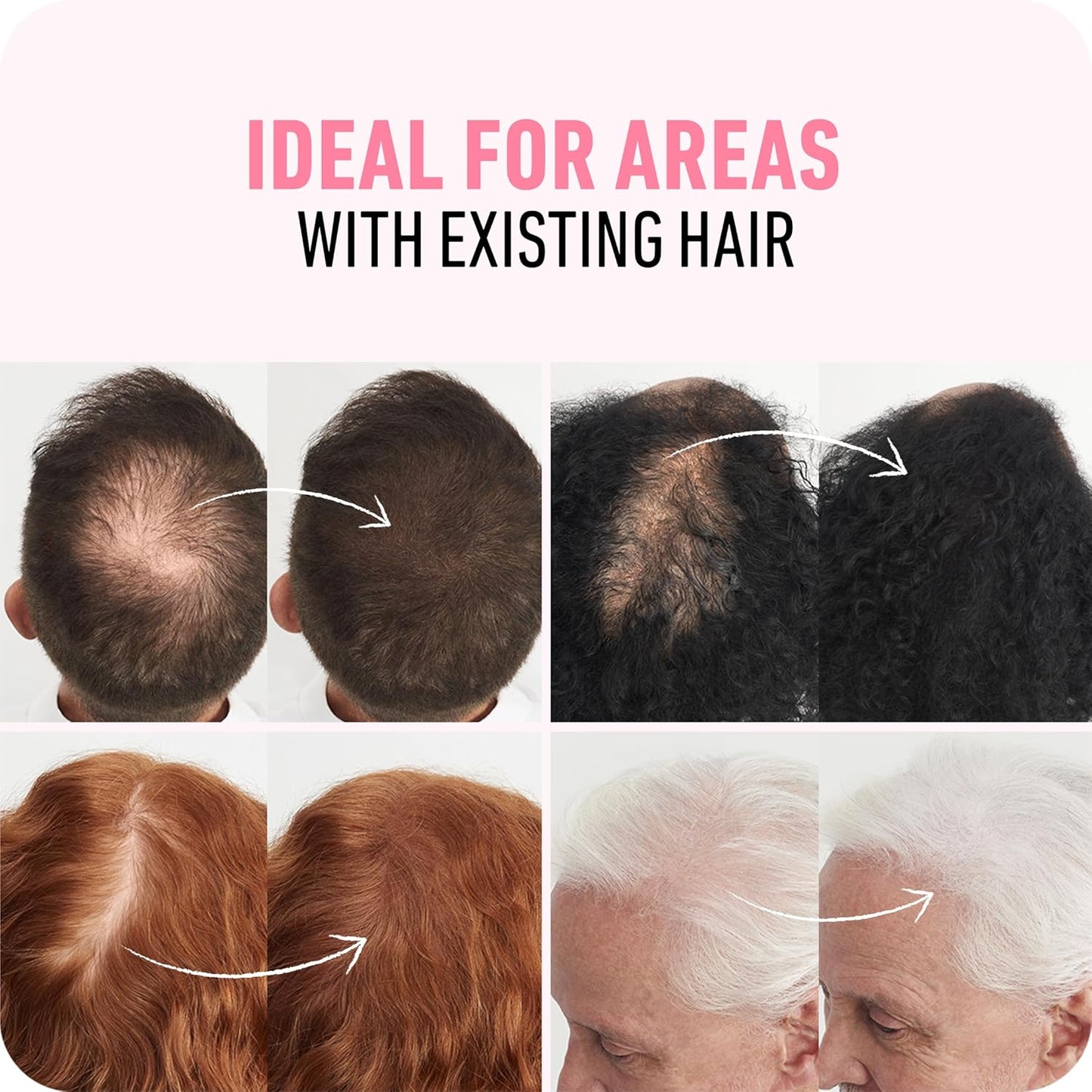 Boldify Hair Fibers | 12g Dark Brown | Thinning Hair Solution for Men & Women