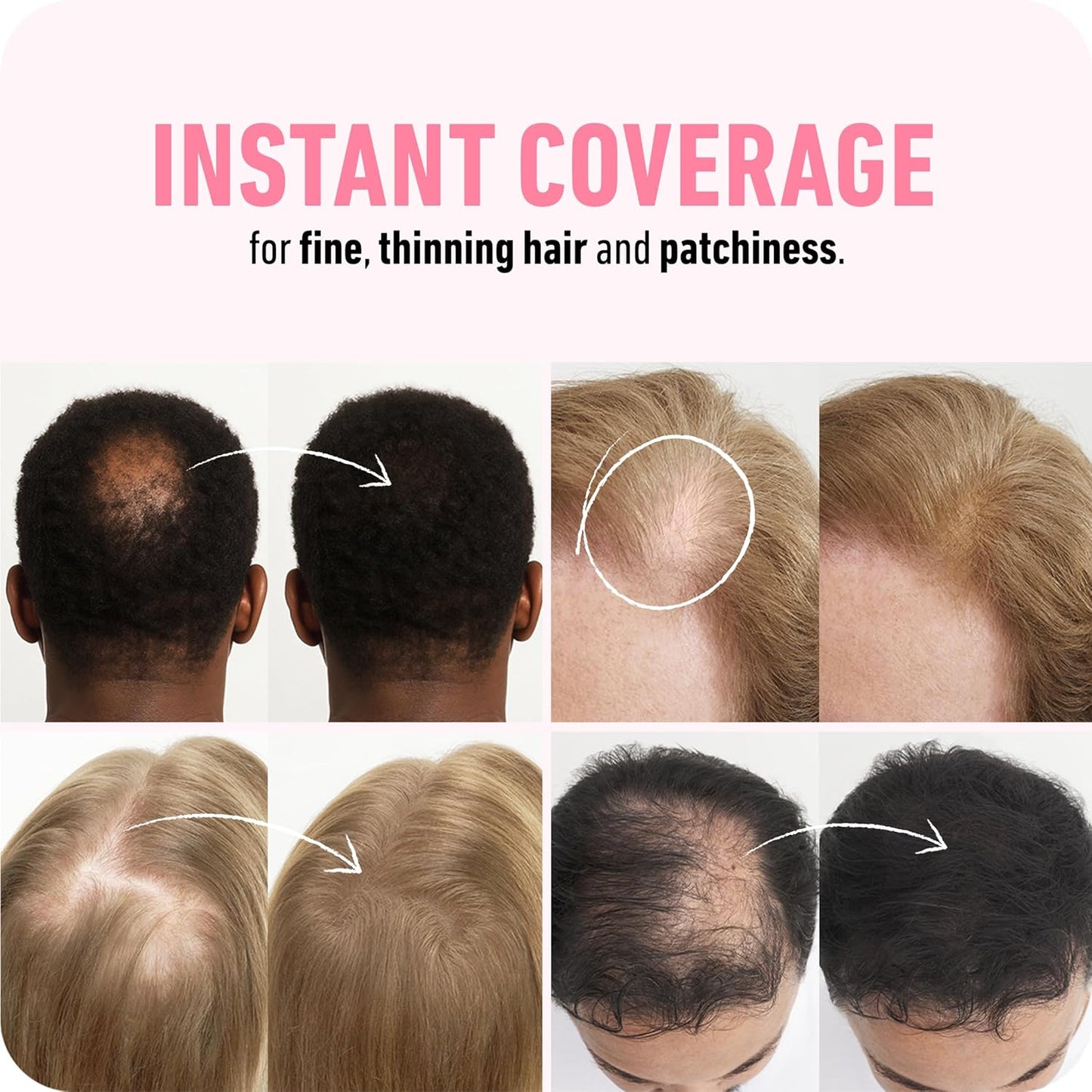 BOLDIFY Hair Fibers 28g | Thinning Hair Solution | Ash Brown for Men & Women