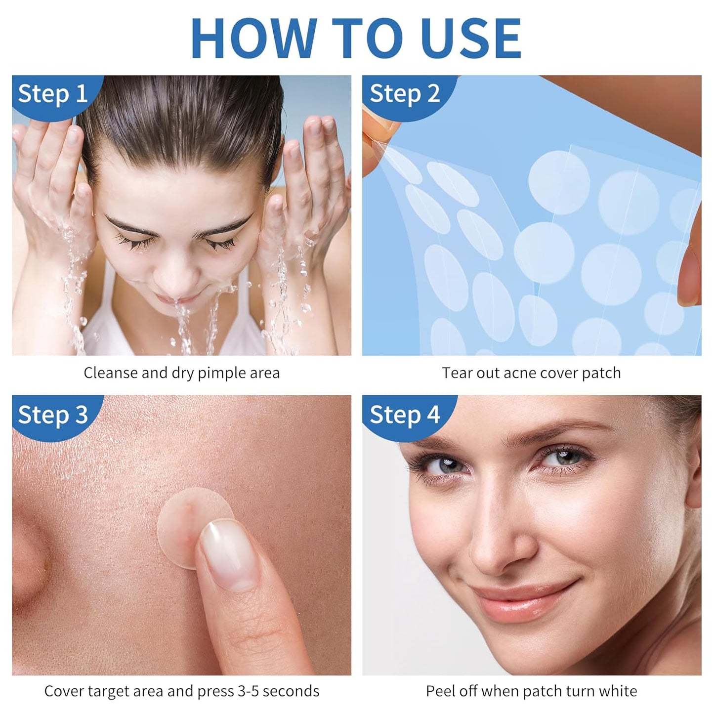 Large Hydrocolloid Acne Patches | 400 Count | Effective Zit Treatment