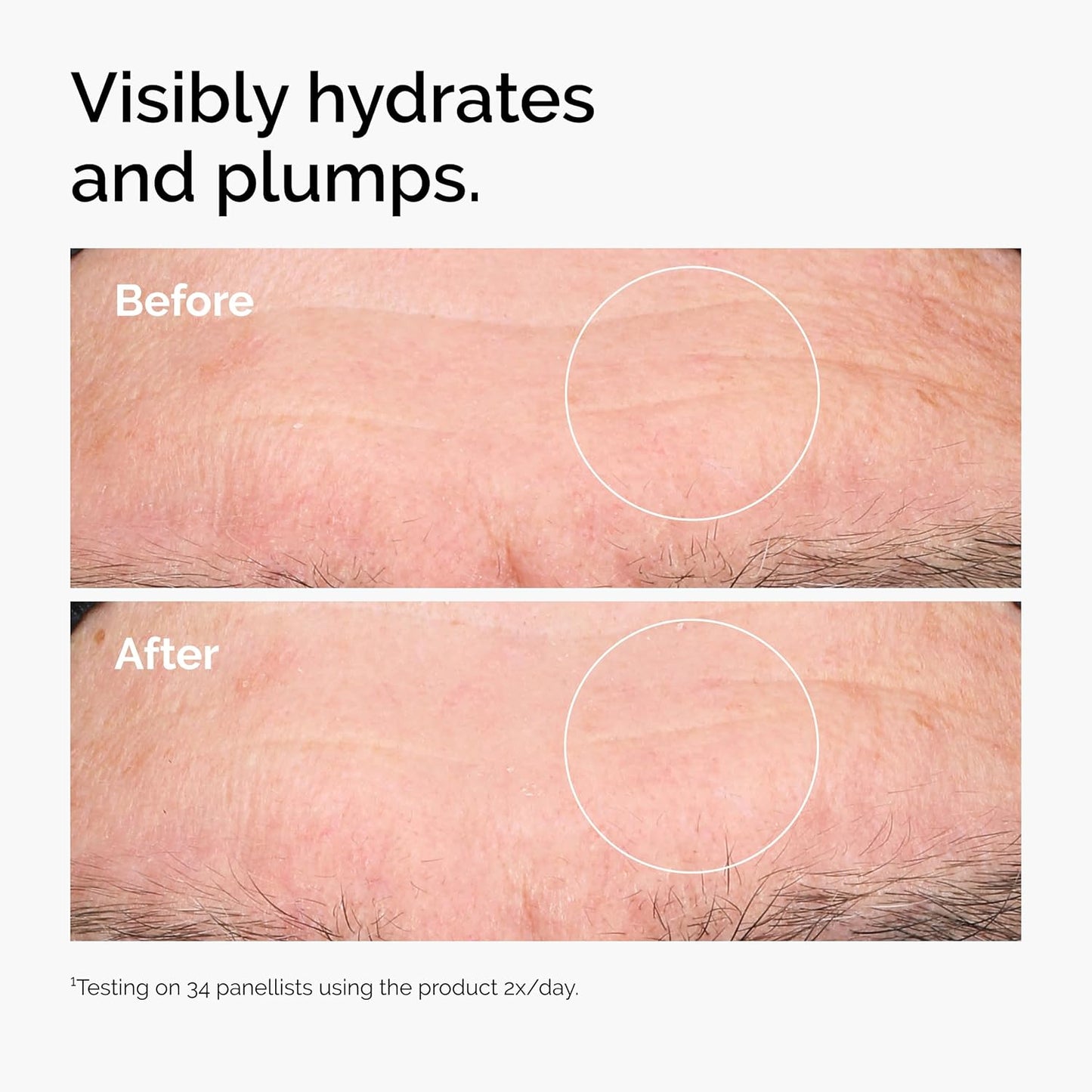 Hyaluronic Acid 2% + B5 Serum | Multi-Depth Hydration for Smoother Skin | 1 Fl Oz