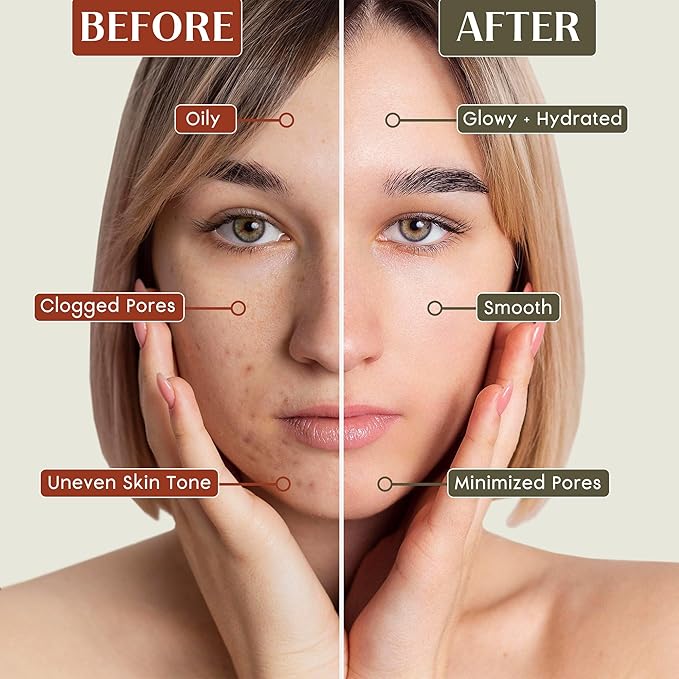 PRANA Sandalwood & Turmeric Face Mask - Natural Cleansing Facial Mask with Ayurvedic Ingredients - Bentonite & Kaolin Clay Mask - Brightening, Hydrating, Anti-Aging - Vegan & Cruelty-Free Mask (110ml)