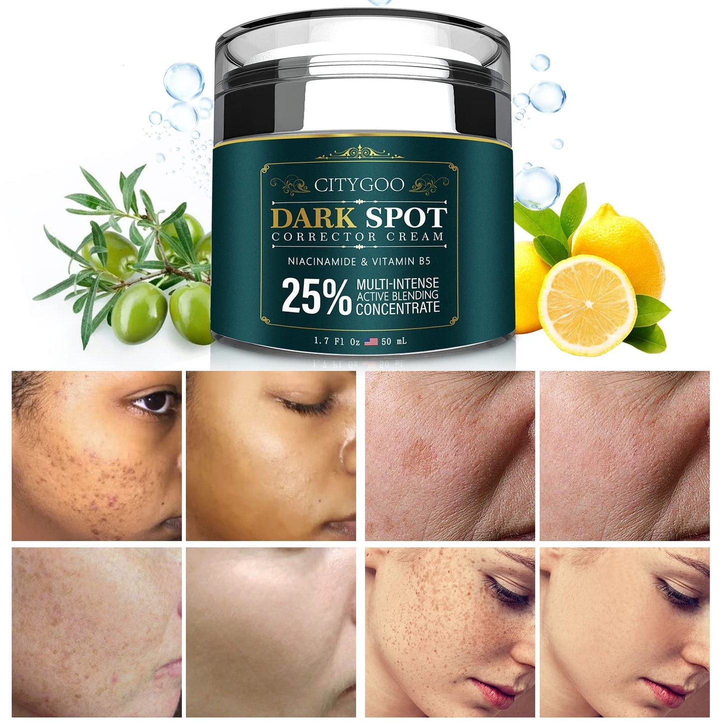 Citygoo Dark Spot Remover For Face And Body, Corrector Cream, Natural Ingredient,Enriching Skin Care For All Skin Tones - Melasm