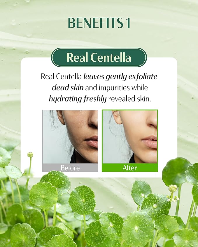 DR.PEPTI Centella Turnover Soft Peeling Gel - Korean Face Exfoliating Scrub with AHA BHA PHA LHA, 6 Peptides - Dead Skin Removal for Dull Rough Skin, 3.38 fl.oz.