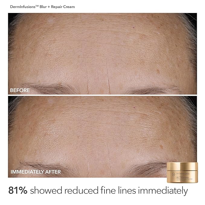 Dr. Dennis Gross Plump & Smooth Limited Edition Kit – DermInfusions™ Blur + Repair Cream (0.67 oz) + 5 Alpha Beta® Universal Daily Peels | $50 Value
